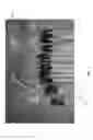 Fig. 06 - CONTINUOUS TENSILE SYSTEM WITH MULTI-STAGE BRAIDING