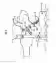Fig. 06 - FILL VALVE LEAK PREVENTION SYSTEM