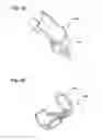 Fig. 06 - Formwork anchor receptacle, a formwork anchor as well as a formwork element for receiving these