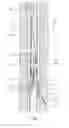 Fig. 02 - Method and device for making a lateral opening out of a wellbore