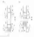Fig. 16 - Method for remediating a screen-out during well completion
