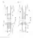 Fig. 17 - Method for remediating a screen-out during well completion