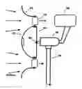 Fig. 01 - High-torque wind turbine