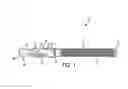 Fig. 02 - Anchor fastener including an expansion sleeve