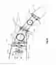 Fig. 15 - COMPOUND MOTION STRUCTURE