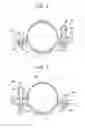 Fig. 03 - Tank fixing apparatus
