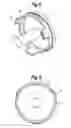 Fig. 06 - Lighting device with central and peripheral illumination