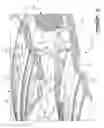 Fig. 04 - Combustor for gas turbine engine