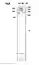 Fig. 09 - Refrigerant compressor with lubricant distribution unit having filter holding chamber with filter body therein