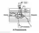 Fig. 01 - Systems and methods for noninvasive blood glucose and other analyte detection and measurement using collision computing