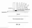 Fig. 174 - Systems and methods for noninvasive blood glucose and other analyte detection and measurement using collision computing