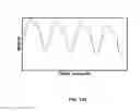 Fig. 201 - Systems and methods for noninvasive blood glucose and other analyte detection and measurement using collision computing