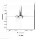 Fig. 77 - Systems and methods for noninvasive blood glucose and other analyte detection and measurement using collision computing