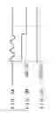 Fig. 03 - Abnormality determination device of fuel property sensor and method of determining abnormality of the same