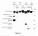 Fig. 03 - POLYVALENT CHIMERIC OSPC VACCINOGEN AND DIAGNOSTIC ANTIGEN