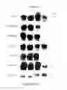 Fig. 20 - POLYVALENT CHIMERIC OSPC VACCINOGEN AND DIAGNOSTIC ANTIGEN