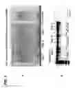 Fig. 02 - USE OF TENASCIN-C AS AN EXTRACELLULAR MARKER OF TUMOR-DERIVED MICROPARTICLES