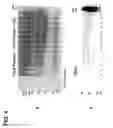 Fig. 05 - USE OF TENASCIN-C AS AN EXTRACELLULAR MARKER OF TUMOR-DERIVED MICROPARTICLES
