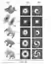Fig. 17 - System and method for early detection of alzheimers by detecting amyloid-beta using orbital angular momentum