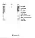 Fig. 11 - Methods and kits for detecting misfolded proteins