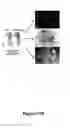 Fig. 17 - Methods and kits for detecting misfolded proteins