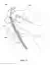 Fig. 04 - FINGER-TOUCH TRACKING SYSTEM