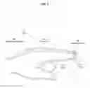Fig. 02 - Use of light transmission through tissue to detect force