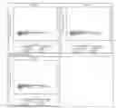 Fig. 07 - Predictive test for aggressiveness or indolence of prostate cancer from mass spectrometry of blood-based sample
