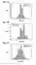 Fig. 13 - Predictive test for aggressiveness or indolence of prostate cancer from mass spectrometry of blood-based sample