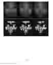 Fig. 04 - SYSTEM AND METHOD FOR DETECTING INVISIBLE HUMAN EMOTION