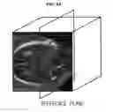 Fig. 08 - Imaging apparatus and controlling method thereof the same