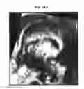 Fig. 22 - Imaging apparatus and controlling method thereof the same