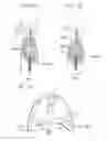 Fig. 03 - Image processing device and program