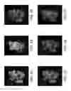 Fig. 25 - Method, system and computer program product for producing a raised relief map from images of an object