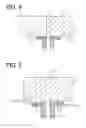 Fig. 04 - Structure for joining ceramic plate to metal cylindrical member