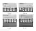 Fig. 07 - Methods of forming an interconnect structure using a self-ending anodic oxidation
