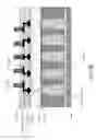 Fig. 29 - 3D high resolution X-ray sensor with integrated scintillator grid