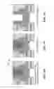 Fig. 07 - Partial sacrificial dummy gate with CMOS device with high-k metal gate