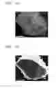 Fig. 07 - Composite negative active material and method of preparing the same, negative electrode including composite negative active material, and lithium secondary battery including negative electrode