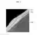 Fig. 04 - POSITIVE ACTIVE MATERIAL FOR RECHARGEABLE LITHIUM BATTERY, AND POSITIVE ACTIVE MATERIAL LAYER AND RECHARGEABLE LITHIUM BATTERY INCLUDING SAME