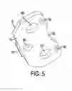 Fig. 06 - Hydraulic power tool