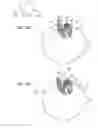 Fig. 17 - Earphone device