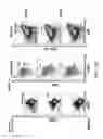 Fig. 18 - Non-human animals with modified immunoglobulin heavy chain sequences