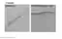 Fig. 01 - Method and Composition for Hypothermic Storage of Placental Tissue