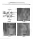 Fig. 08 - Method and Composition for Hypothermic Storage of Placental Tissue