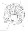 Fig. 10 - Noise reducing water resistant headpiece