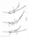 Fig. 04 - HAIR TWIST