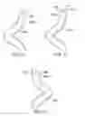 Fig. 11 - HAIR TWIST
