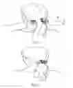 Fig. 02 - Adjustable Fastener