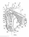 Fig. 03 - Backpack